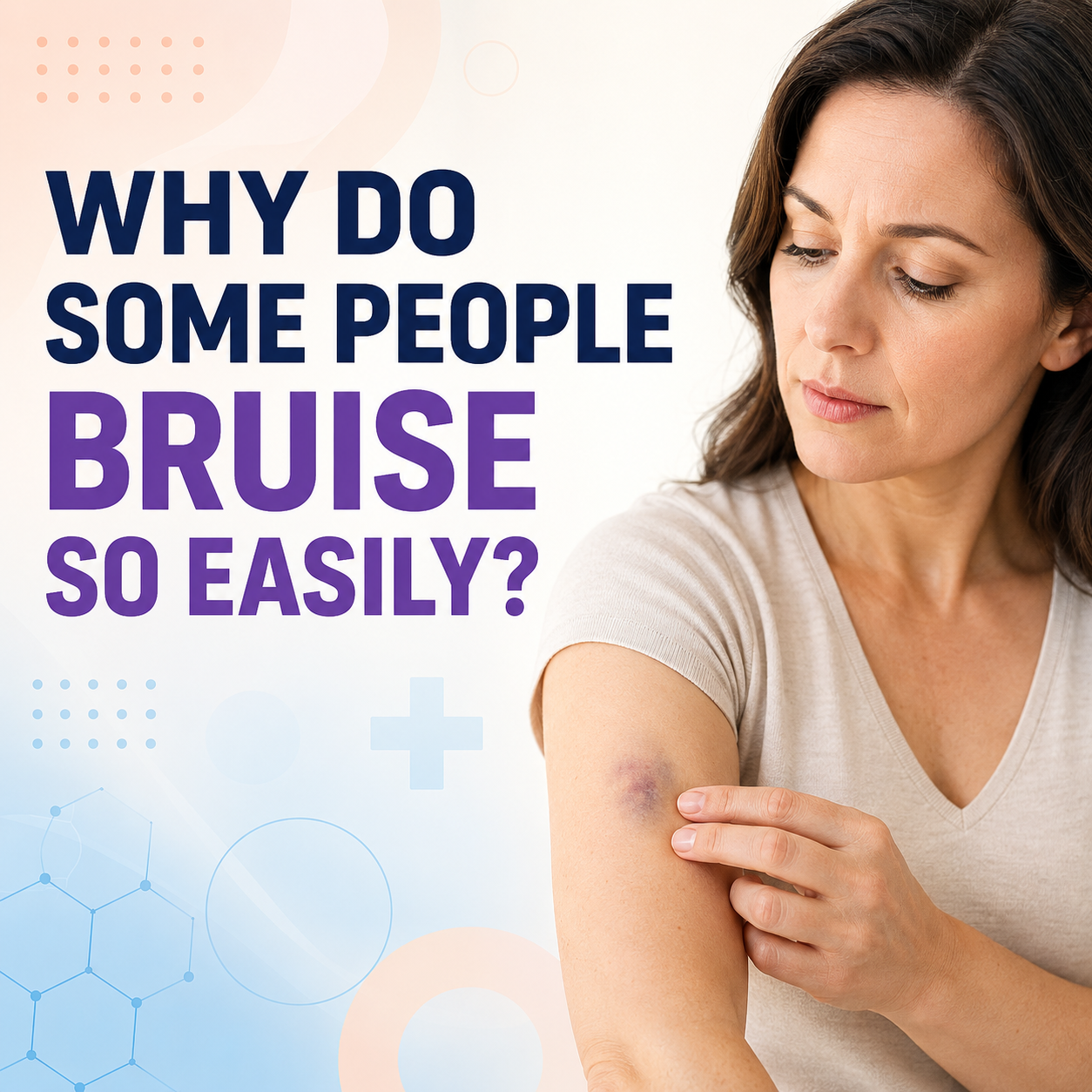 Why Do Some People Bruise So Easily? | Ecura Health Why Do Some People Bruise So Easily? | Ecura Health