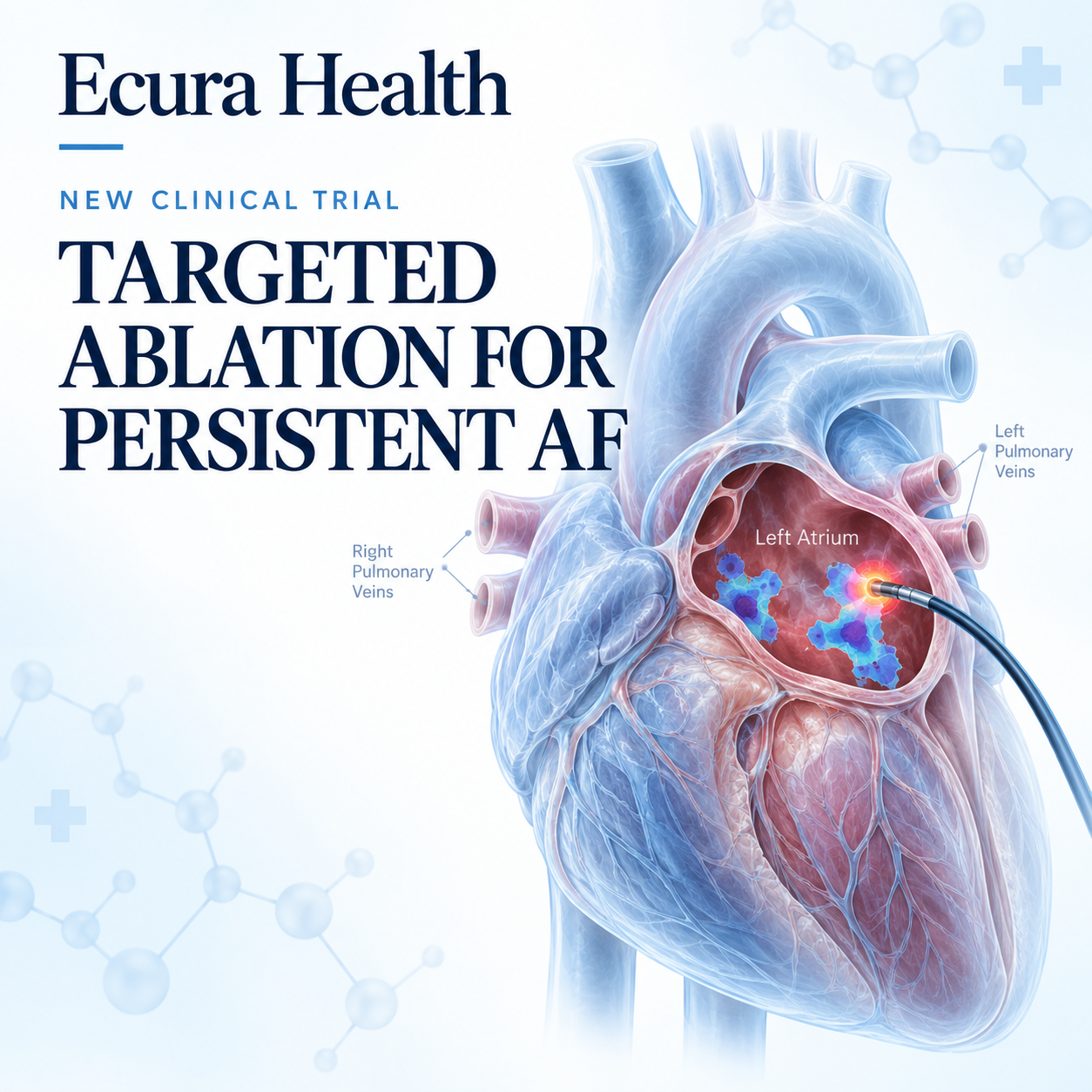 mn 20260905 003 targeted af ablation trial thumbnail